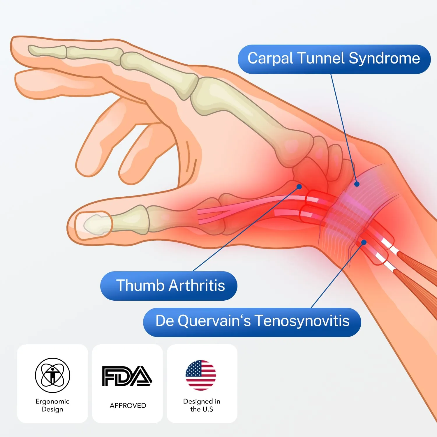 All-in-One Thumb Brace with Palm & Wrist Stabilizer: Pain Relief for Carpal Tunnel, De Quervain's Tenosynovitis, Tendonitis, Arthritis, Unisex Design (Left Hand, S/M)